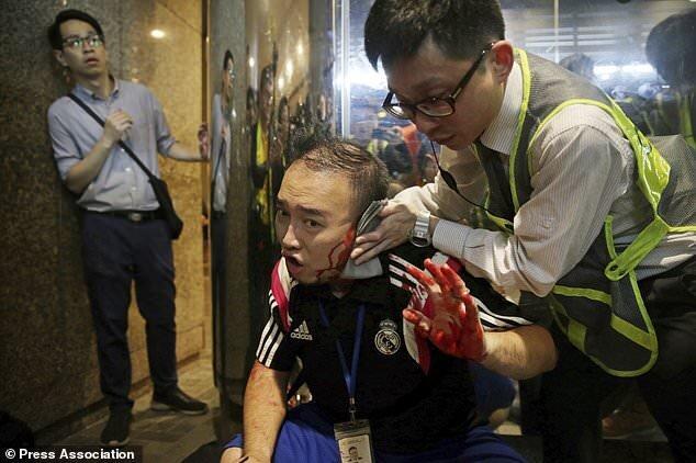 70 تن در درگیری های هنگ کنگ زخمی شدند