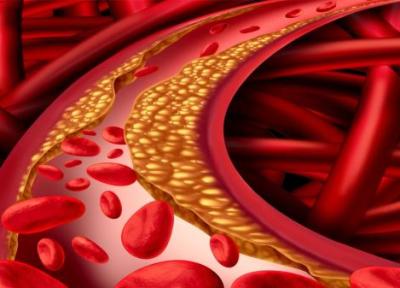 چگونه کلسترول خون را کاهش دهیم؟
